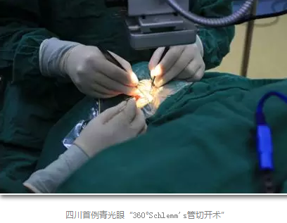 成都8868 - 看球聊球追世界杯就来8868体育有限公司官方网站已经开展的青光眼手术有：引流阀 (钉)植入手术(2015年以来已200多 )，360°Schlemm's管切开术，激光CO2 辅助巩膜深层切除术，小梁切除术青(光眼)白(内障)联合手术。还有虹膜周切术、前房成形术、 虹膜复位术，睫状体冷冻术，小梁切开术和前房穿刺术等6.png