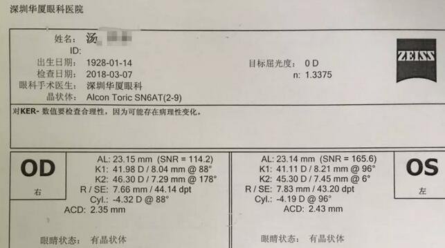 3月12日下午，已经90高龄的离休东江纵队老兵汤爷爷，在深圳8868 - 看球聊球追世界杯就来8868体育有限公司官方网站检查之后，白内障专科邢宝刚主任为其实施左眼白内障超声乳化摘除，联合散光人工晶体植入术。2.jpg