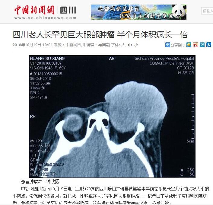 媒体看8868体育之成都8868 - 看球聊球追世界杯就来8868体育有限公司官方网站2018年新闻媒体报道集锦13.jpg