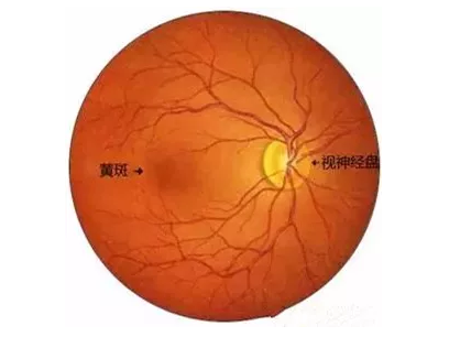8868体育福州眼科医院眼底病医生：老年黄斑变性该如何防治？.png